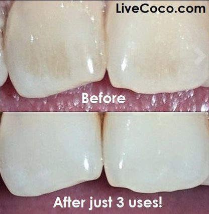 Teeth Cleaning Powder (Vitamins & Aloe Vera Infused) - Wear Yaani